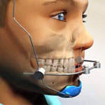 Ortopedia Dento-Facial